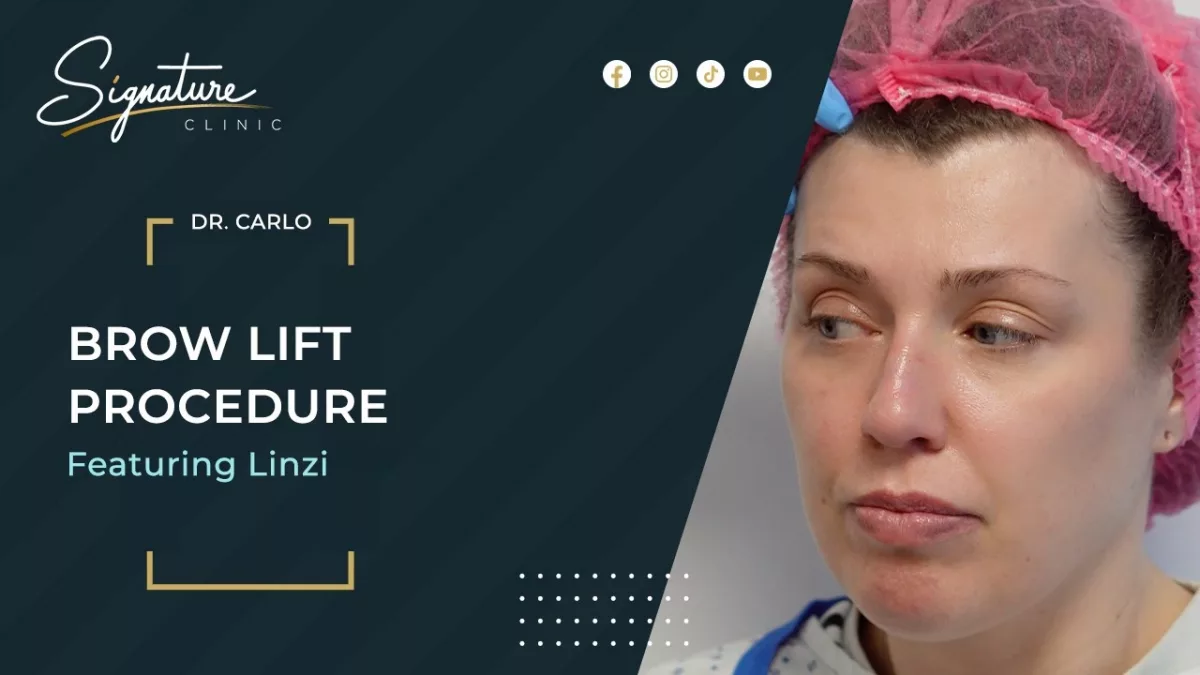 Follow patient Linzi as she visits Signature Clinic for a Lateral Brow Lift