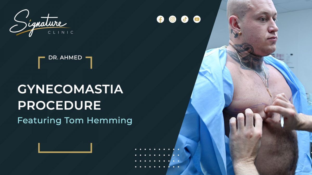 Competitive Bodybuilder Undergoes Gynecomastia Surgery with Signature Clinic