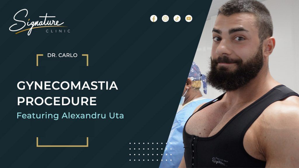Former Mr Universe Receives Signature Gynecomastia Surgery