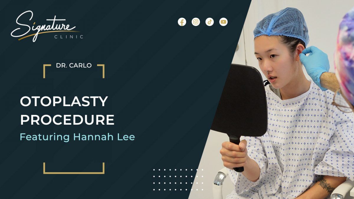 London Student Reclaims Confidence Through Otoplasty at Signature Clinic